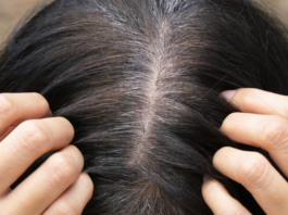 Why does Hair Turn Gray?