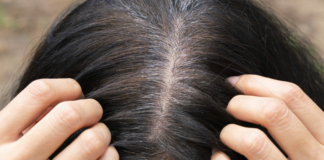 Why does Hair Turn Gray?